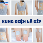 dien-xung-phuc-hoi-chuc-nang