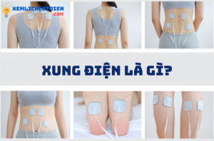 dien-xung-phuc-hoi-chuc-nang