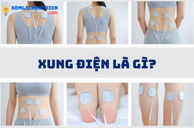 dien-xung-phuc-hoi-chuc-nang